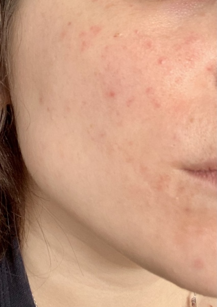 What is happening with my skin?!