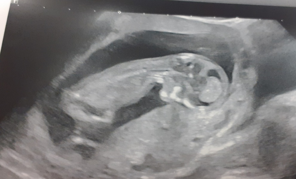 Due September 4.5 🐣♥️🧡💜