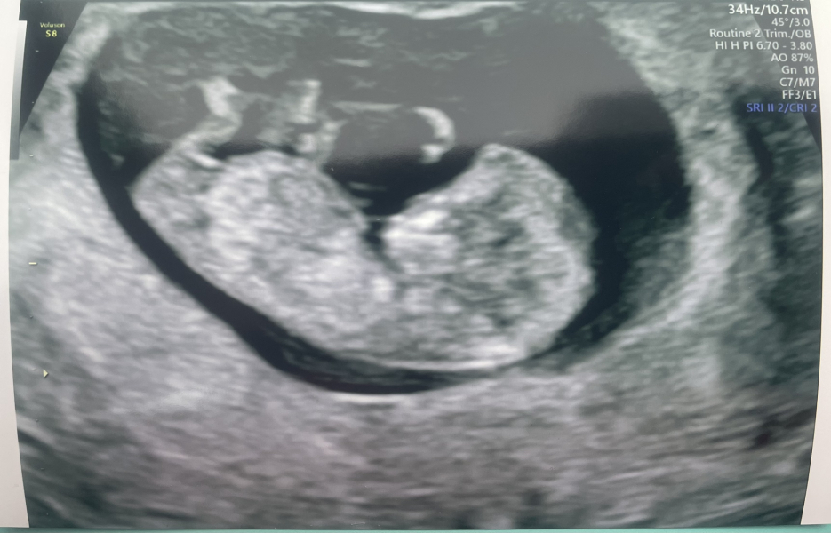 Due September 4.5 🐣♥️🧡💜