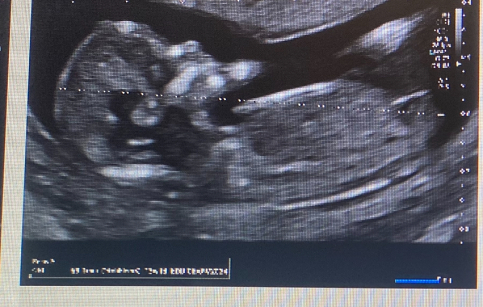 Boy or girl