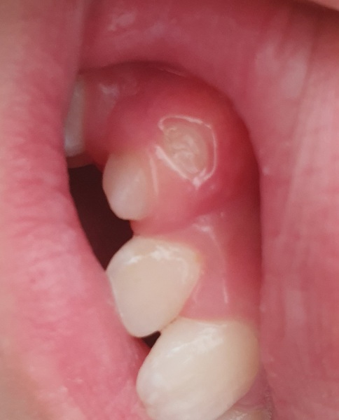 Any dentists around?