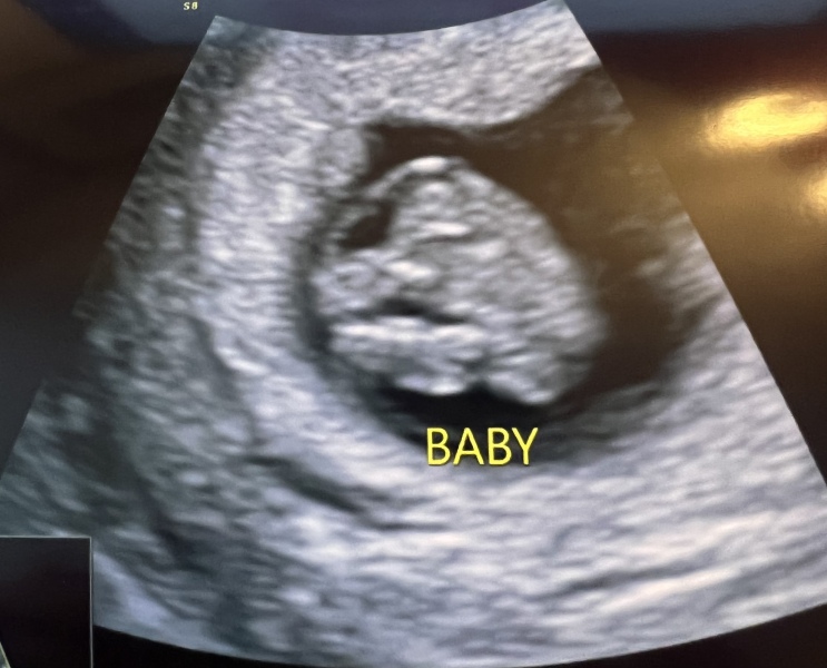 October 2024 Babies thread 2 👶