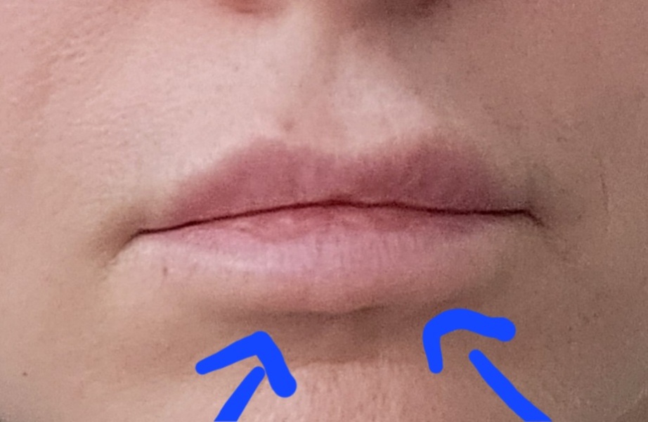 Question for Aesthetic practitioners