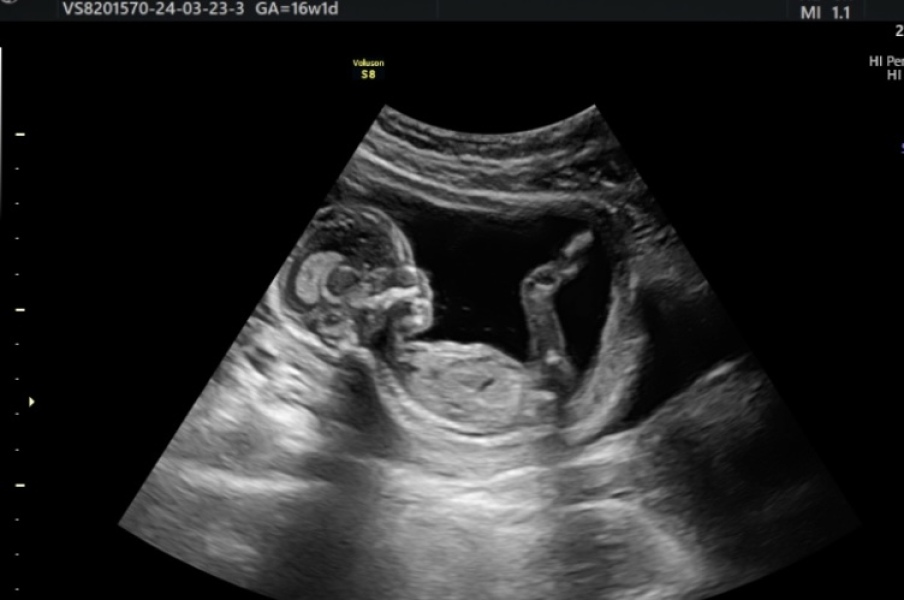 Due September - Thread 5! 🐣❤️🧡💛