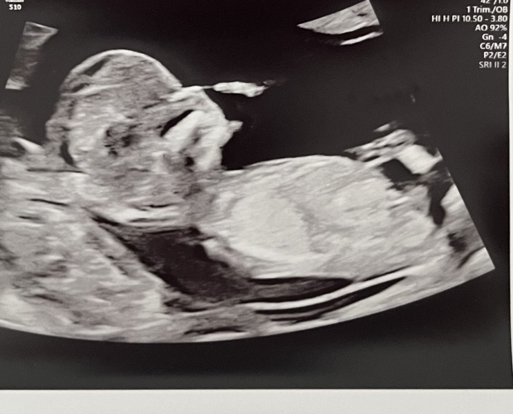 OCTOBER 2024 BABIES :) THREAD 3