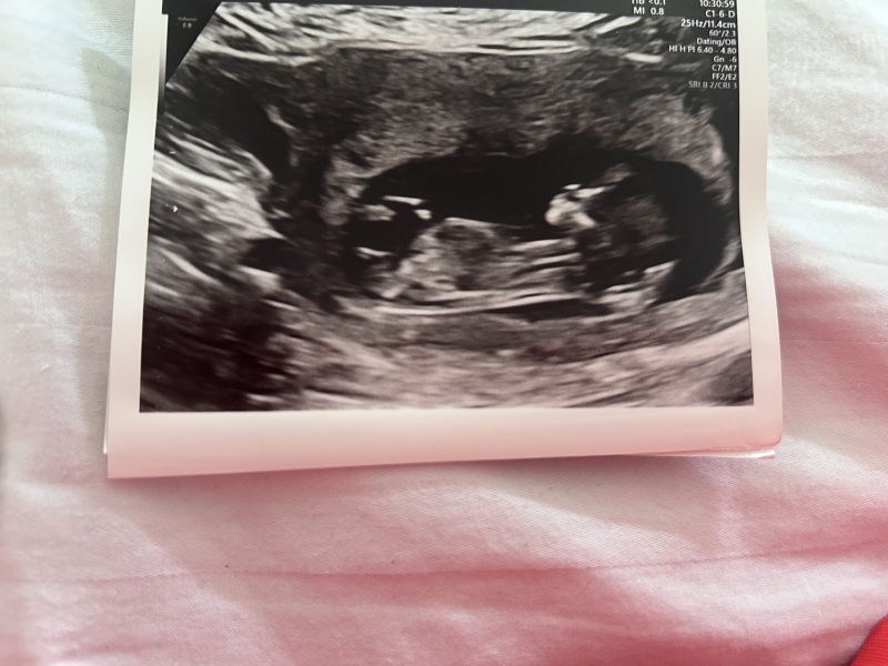 OCTOBER 2024 BABIES :) THREAD 3