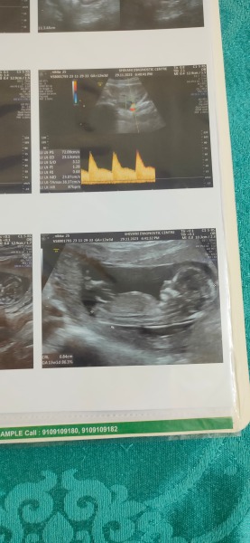 pregnancy