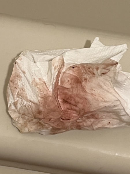 Implantation bleeding?