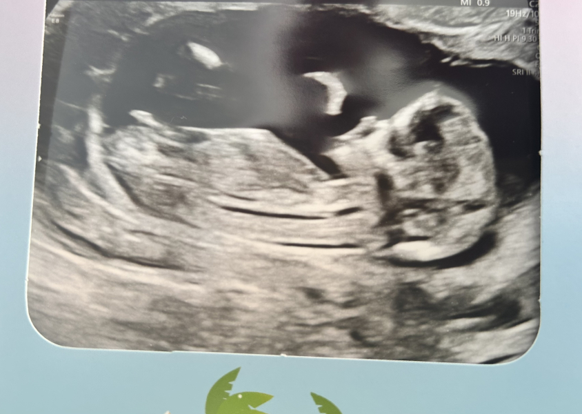 Due September - Thread 5! 🐣❤️🧡💛