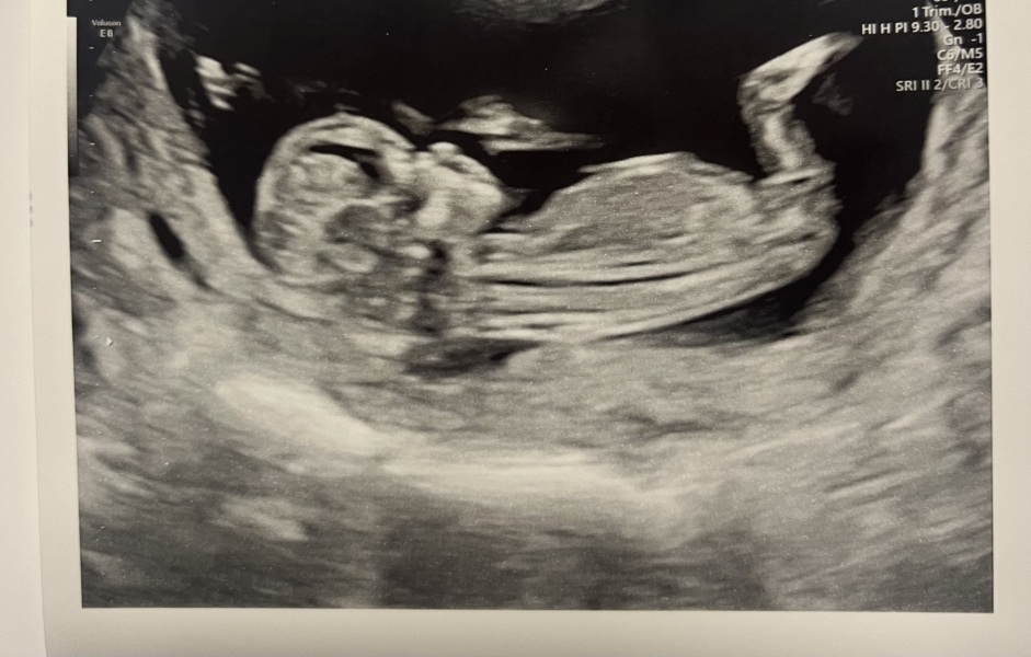 OCTOBER 2024 BABIES :) THREAD 3