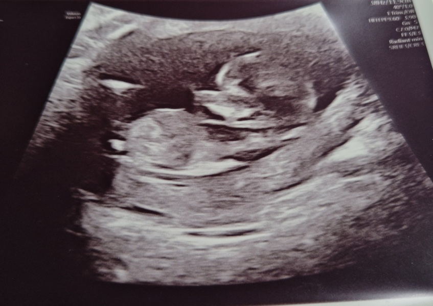 Due September - Thread 5! 🐣❤️🧡💛