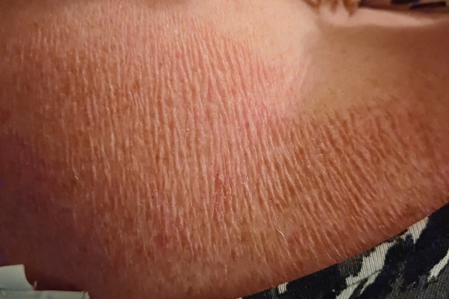 What the hell happened to my back? (Picture included)