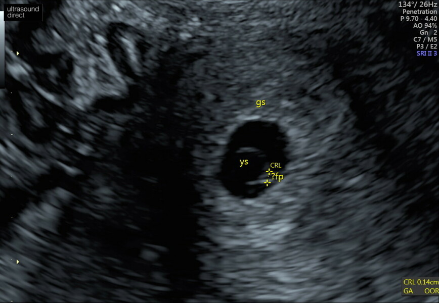 November 2024 Babies- Part 2!