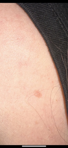 Mole like things