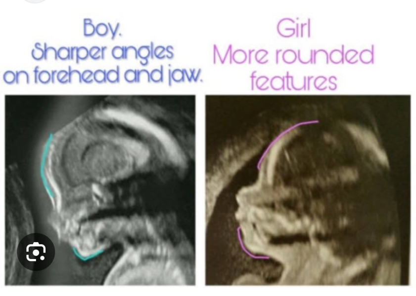 BOY OR GIRL? 12 week scan pic.