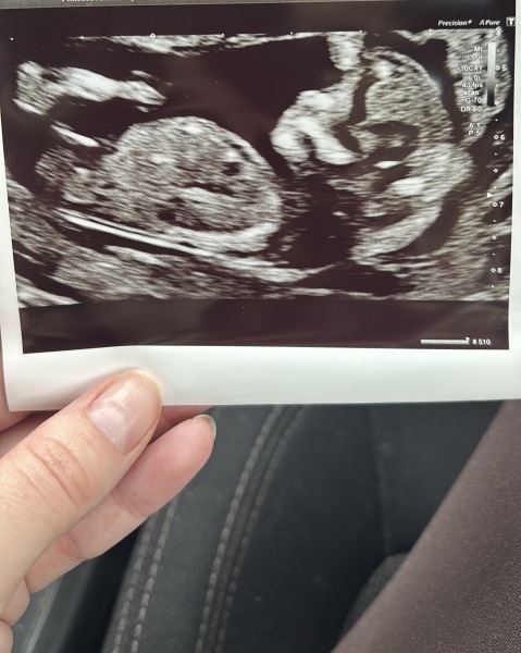 Has anyone had nub theory be wrong?