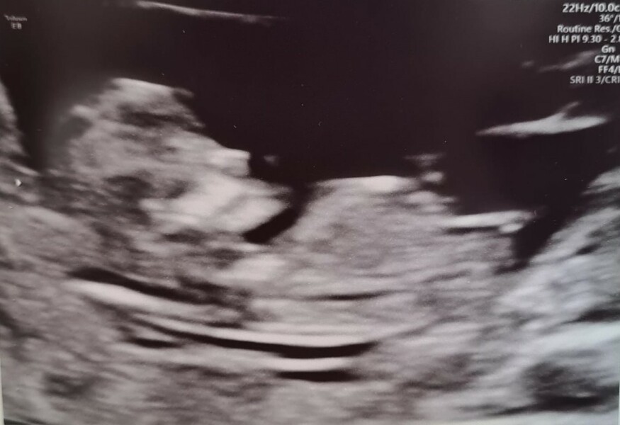 Due September 4.5 🐣♥️🧡💜