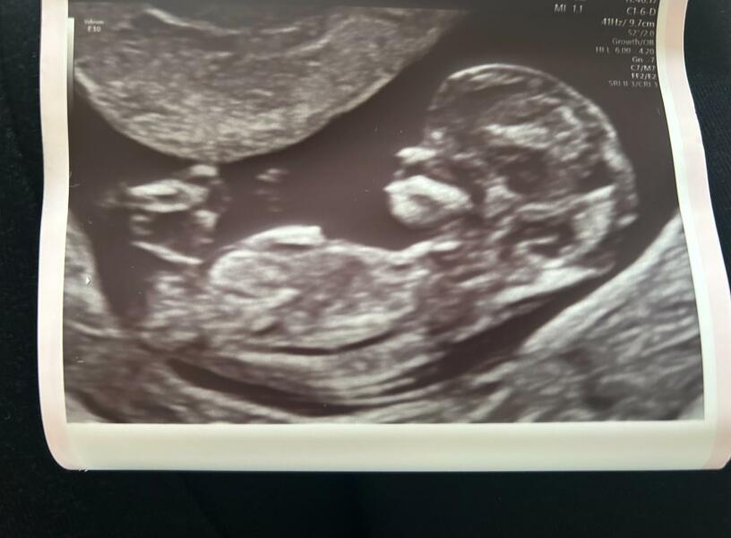 Due September 4.5 🐣♥️🧡💜