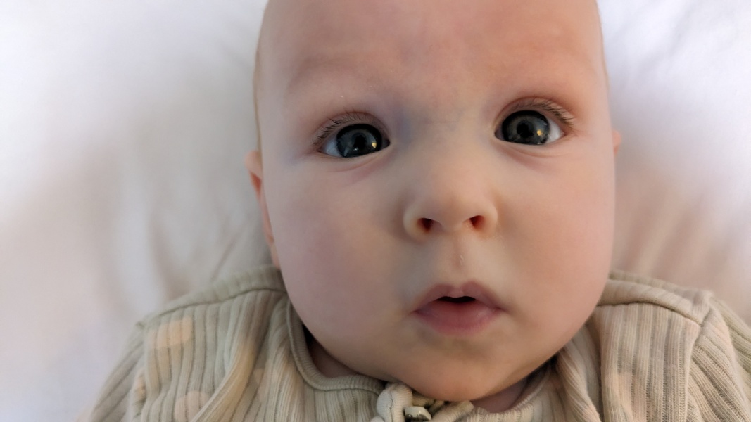 Aibu to think my baby has different sized eyes?