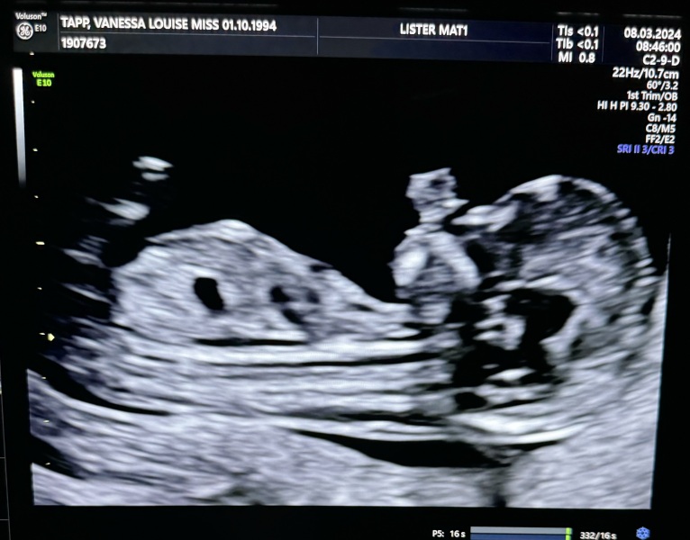 Due September 4.5 🐣♥️🧡💜