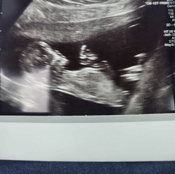 Due September - Thread 5! 🐣❤️🧡💛