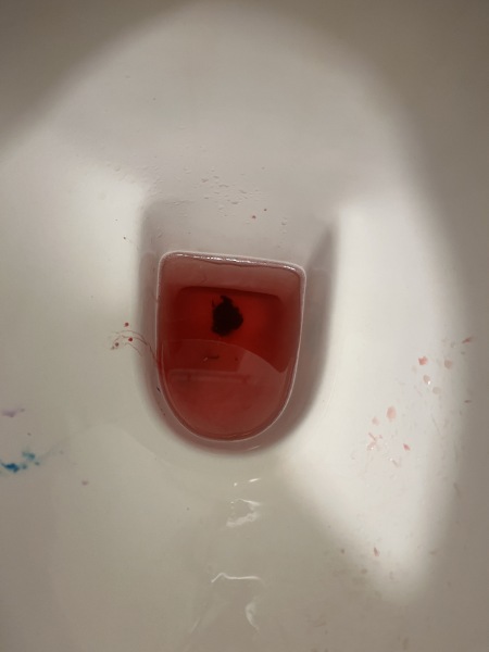 Blood clot or miscarriage