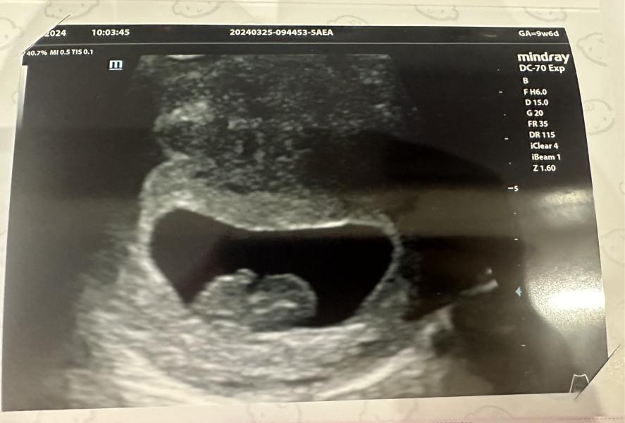 OCTOBER 2024 BABIES :) THREAD 3