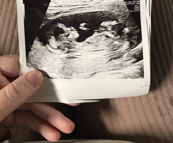 Due September - Thread 5! 🐣❤️🧡💛