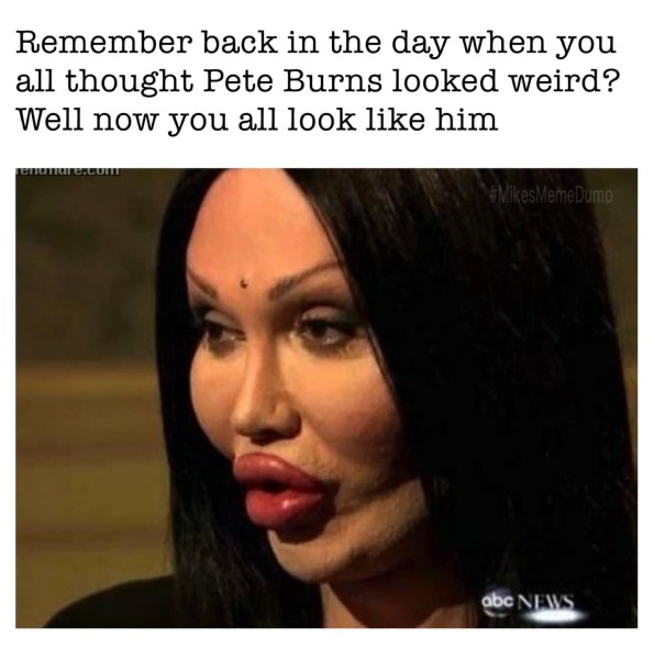 Botox, frozen faces and big lips