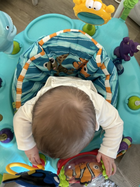 Is this Plagiocephaly? Also, does plageodephaly cause brain damage/delays?