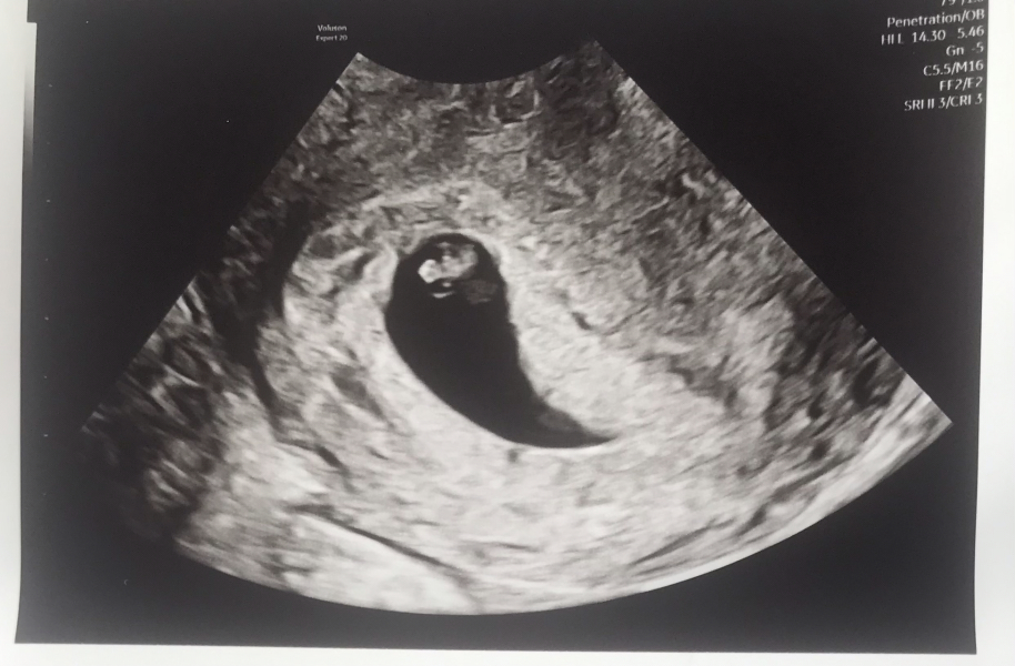 October 2024 Babies thread 2 👶
