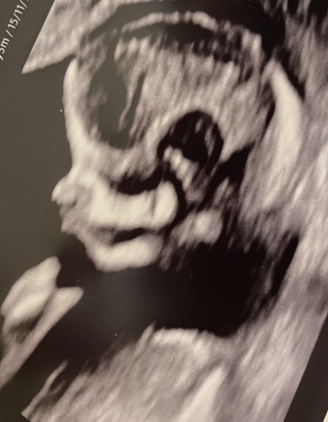 Boy or girl?