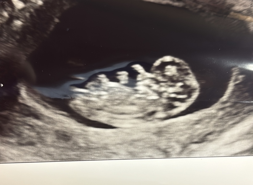 Boy or girl ? 🩵💜