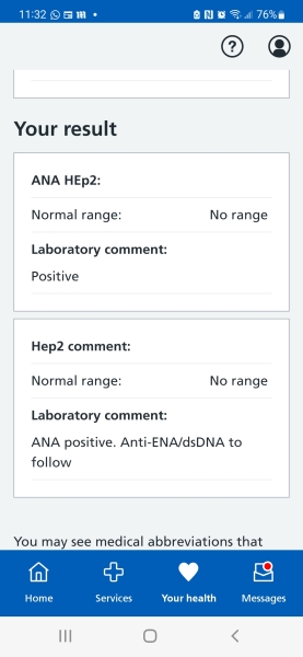 ANA Hep2 blood test positive