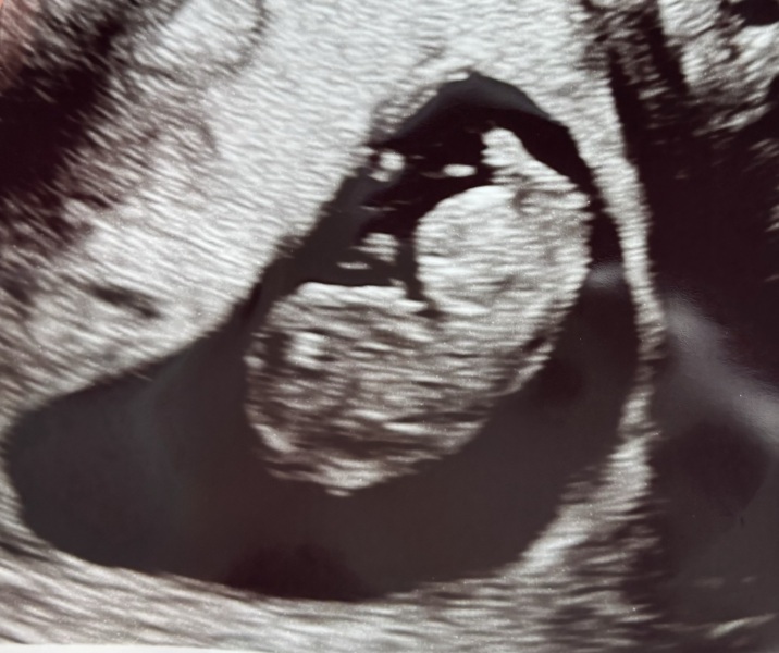 OCTOBER 2024 BABIES :) THREAD 3