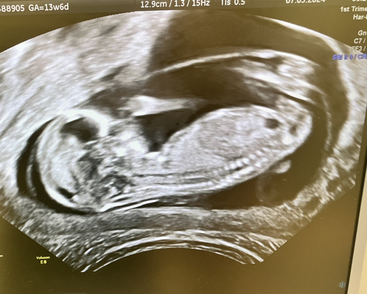 Due September 4.5 🐣♥️🧡💜