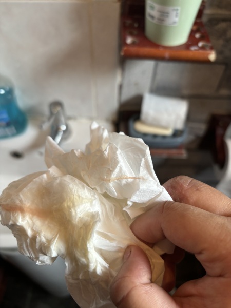 Mucus Plug