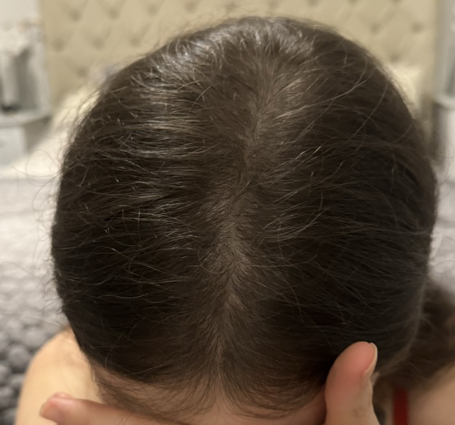 Am I going bald??? See images