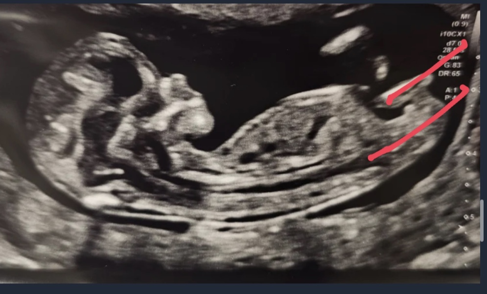 Due September - Thread 5! 🐣❤️🧡💛