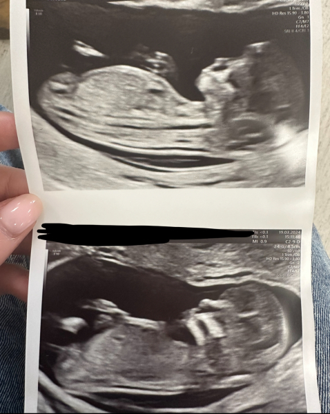 Boy or girl?! Nub theory guesses?!