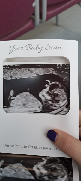 Gender?