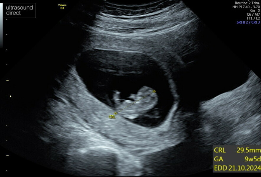 OCTOBER 2024 BABIES :) THREAD 3