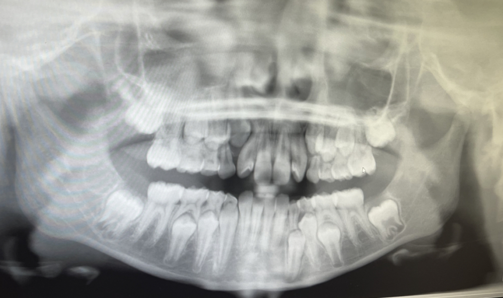 Any Dentists/ortho can advise?