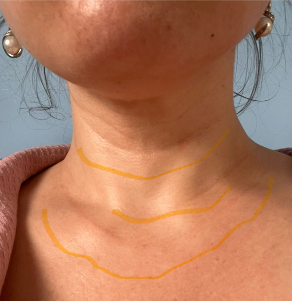 weird circles , should i be worried
