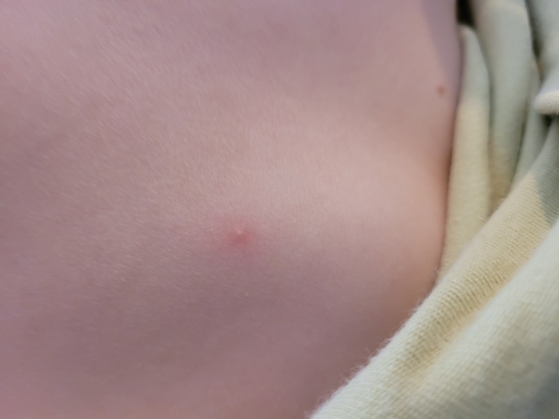 What are these spots?