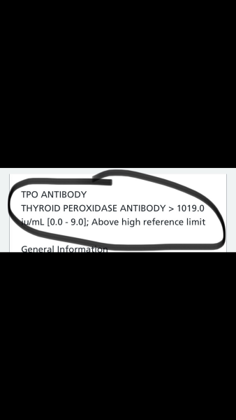 Hashimotos/blood test /HELP