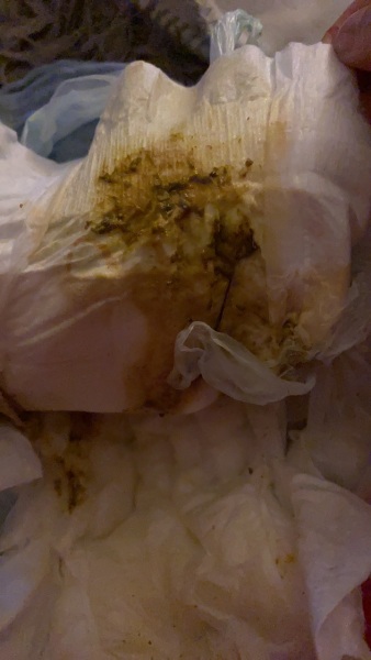 Teething at 8 weeks? TMI WARNING