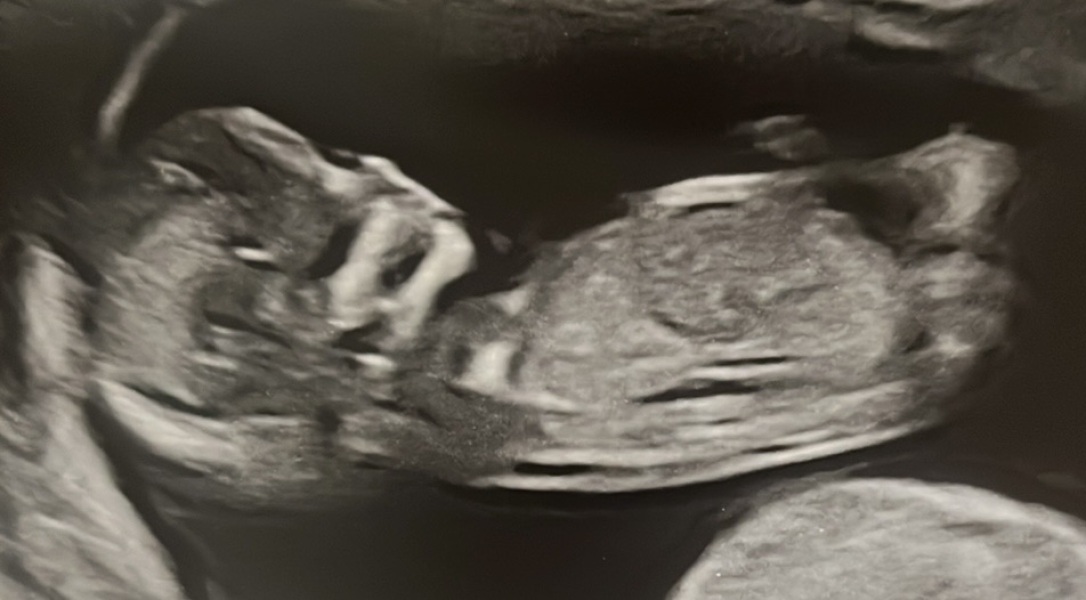 Guess the gender? Just for fun