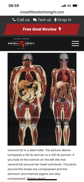 What should the government do to reduce obesity at the societal level?