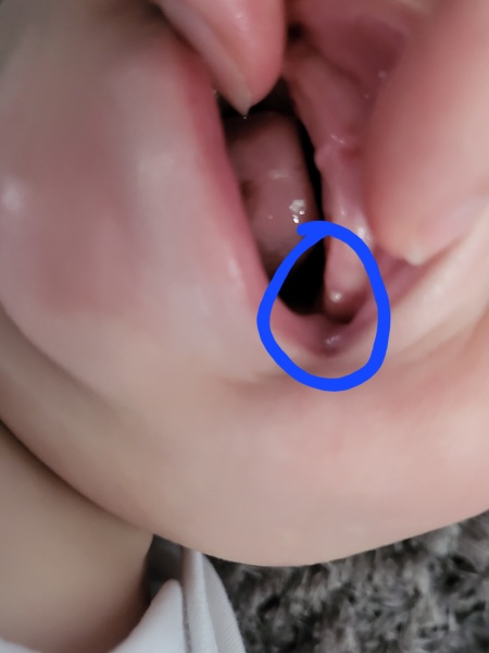 Tooth or not?